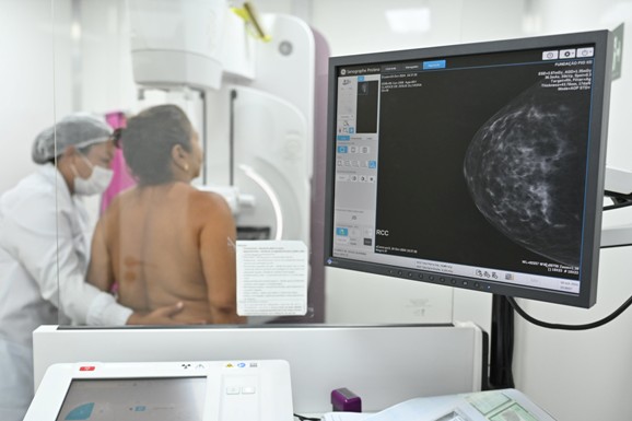 Dia Nacional da Mamografia: ALE-RR reforça ações e leis para ampliar acesso a exame em Roraima